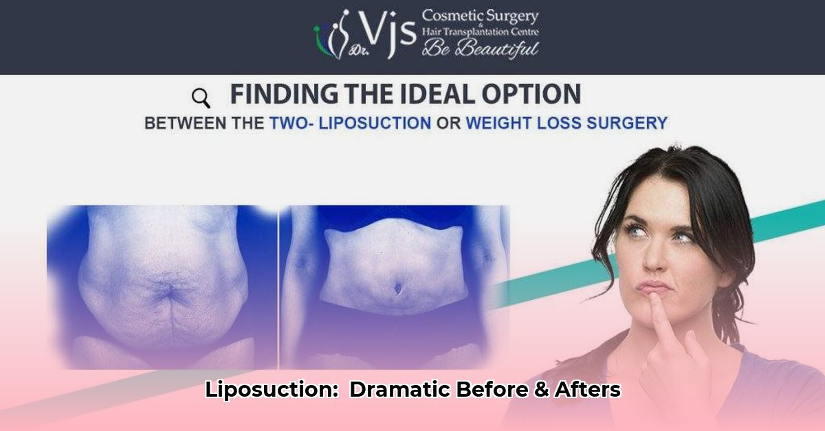 liposuction-for-weight-loss-before-and-after